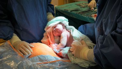 Duben, měsíc císařských porodů, si připomínají také v Nemocnici AGEL Ostrava-Vítkovice